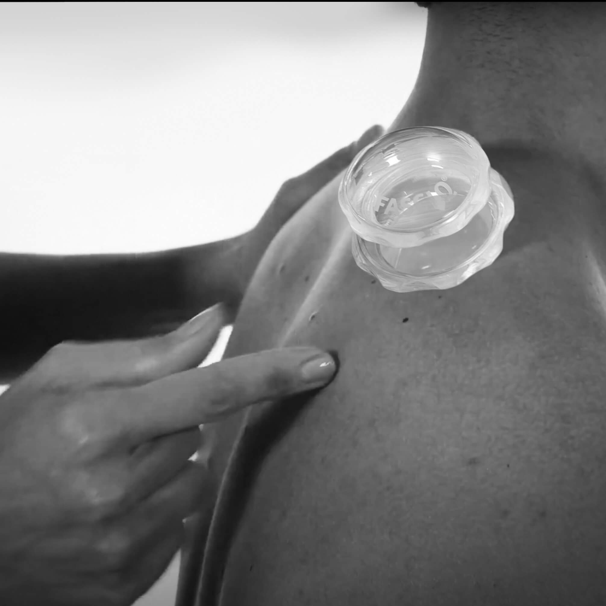 FASCIQ® <span>Ultimate Cupping Collection</span> - Image 17