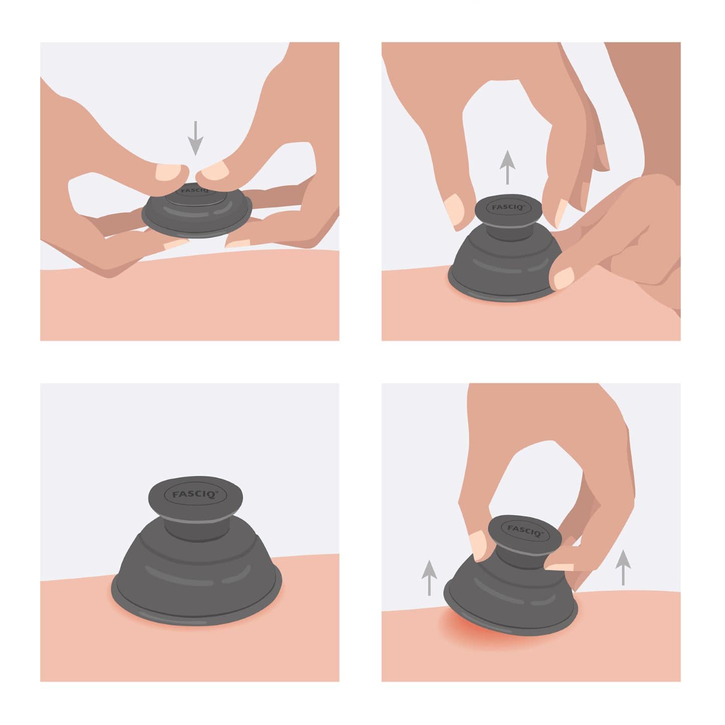 FASCIQ® <span>Ultimate Cupping Collection</span> - Image 6